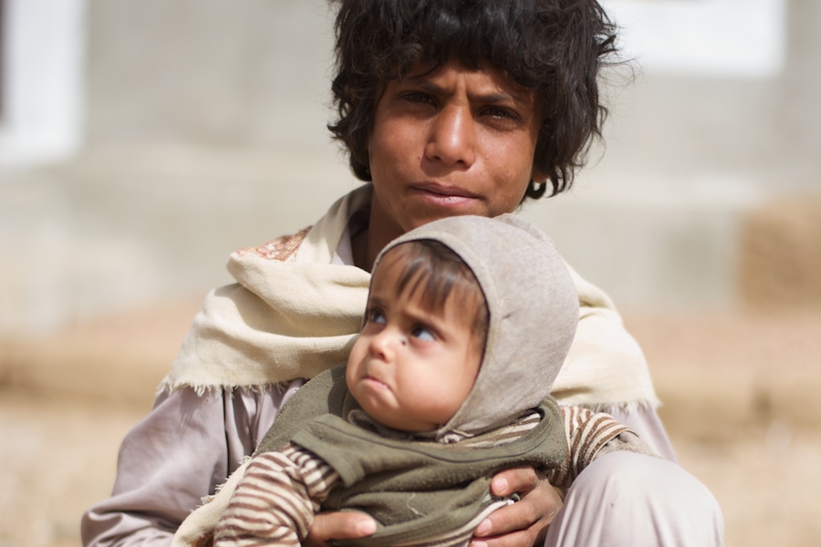 Children in Yemen: malnutrition. A boy holds his malnourished brother in Kitaf.