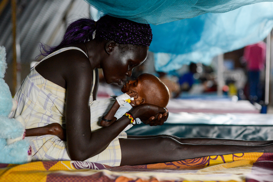 UNICEF provides treatment for malnutrition in South Sudan.