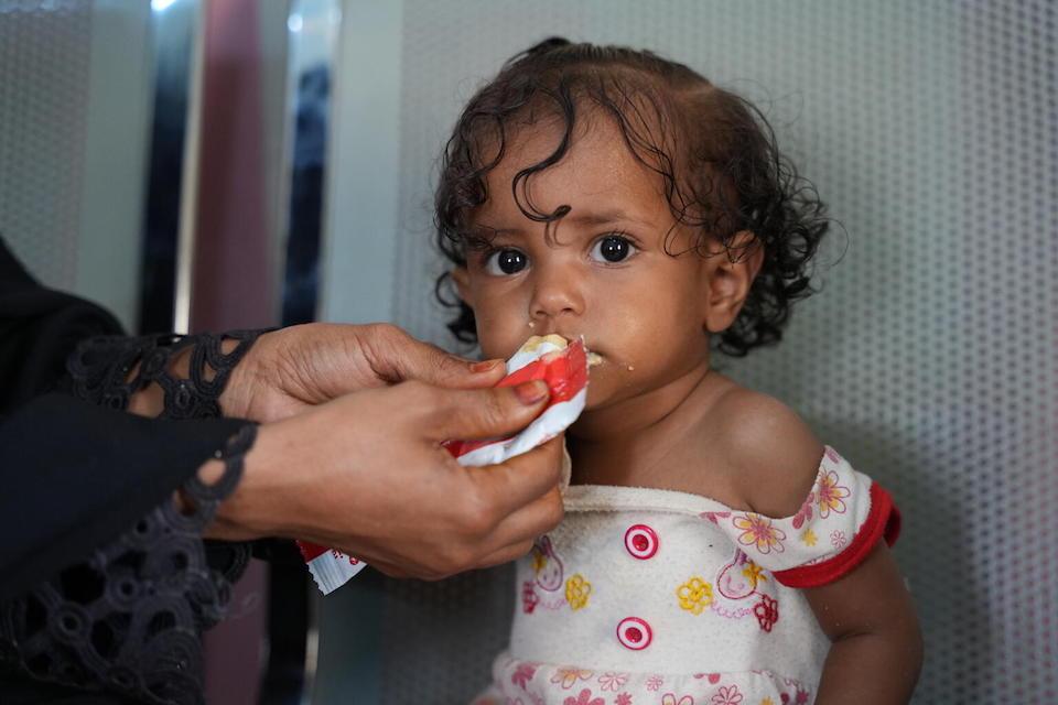 A child who has been suffering from malnutrition, is fed Ready-to-Use Therapeutic Food at Al-khatabiah health facility in Tur Al-Bahah, Lahj governorate, Yemen.