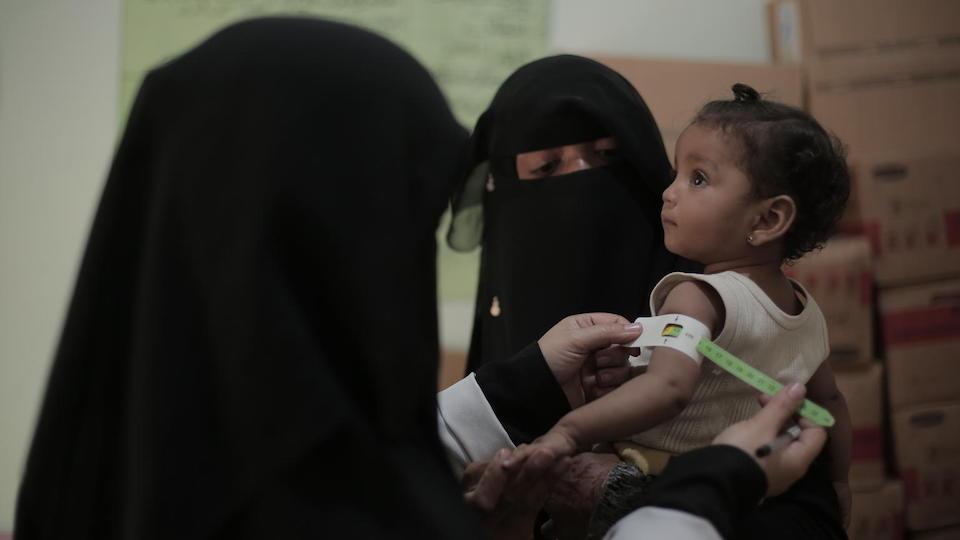Nine-month-old Nour is checked by medical staff at a health center in Sana'a, Yemen.