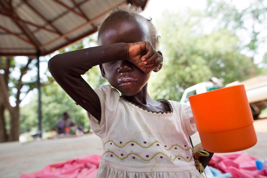 Diagnosed with severe acute malnutrition, Maria, 2, drinks a ration of therapeutic milk rich in nutrients at a UNICEF-supported inpatient stabilization center in Juba, South Sudan in October 2017.
