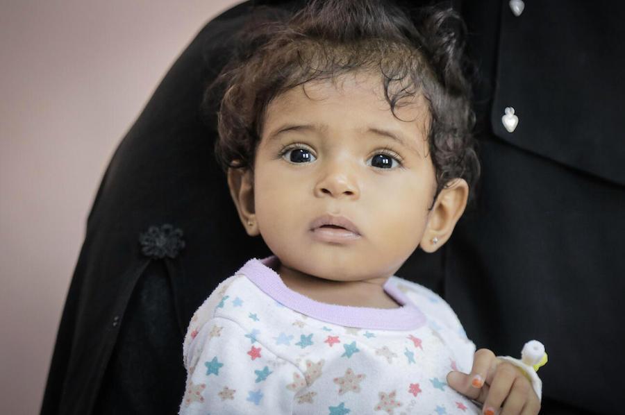 On April 20, 2021, 1-year-old Afnan is treated for malnutrition at the UNICEF-supported Therapeutic Feeding Center in Al Marawi'ah district, Hudaydah Governate, Yemen.