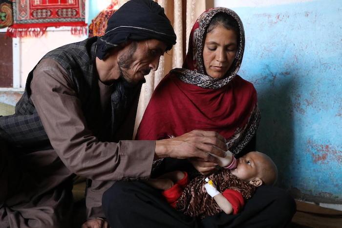 In Kabul, Afghanistan, a father feeds his baby daughter therapeutic milk as she lays cradled in her mother's lap.
