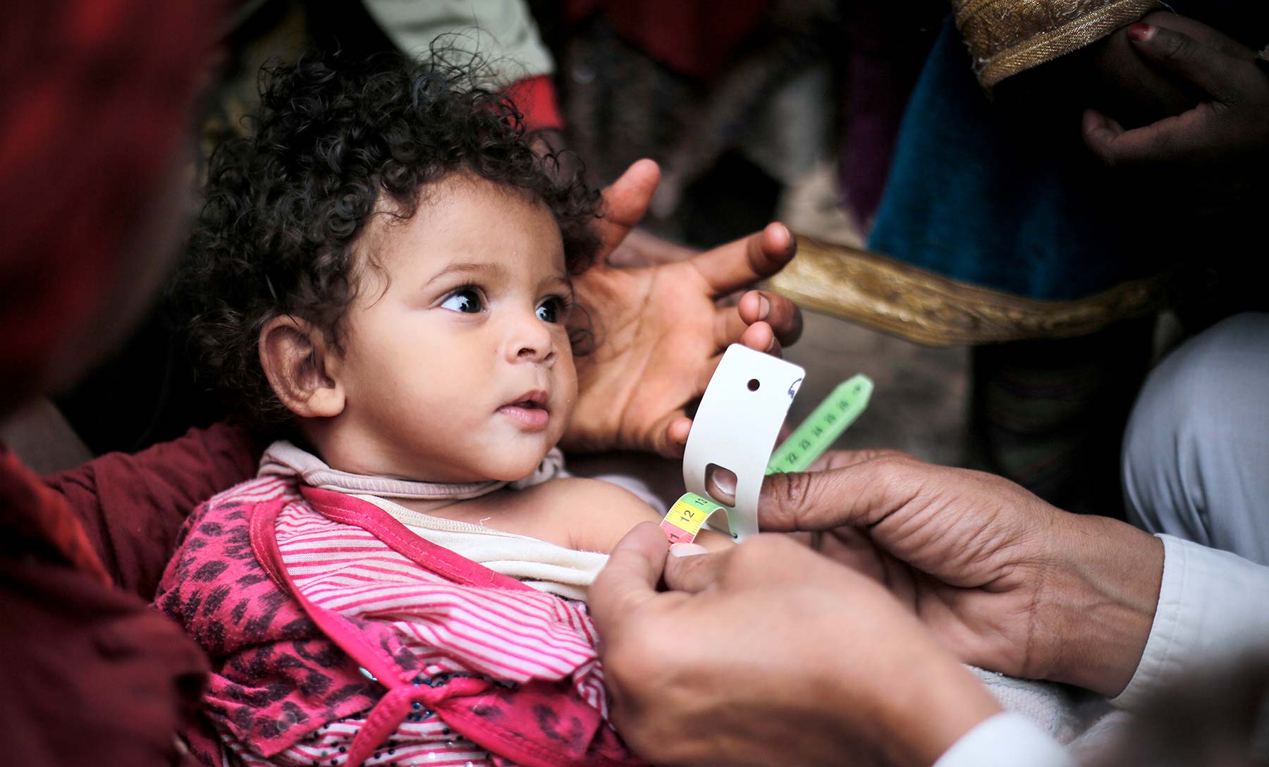 Six Ways Yemen is in Crisis - Famine photo
