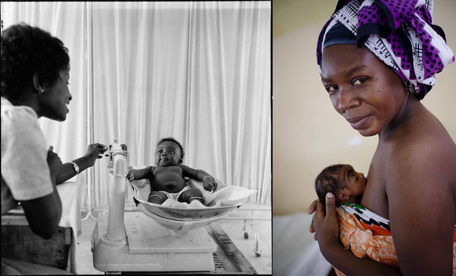 (Left) In 1960 in Ghana, a midwife weighs a child on a scale in a comprehensive long term rural health plan emphasising training of medical personnel in Tuma. (Right) In 2014, a woman cradles her preterm baby using ‘kangaroo care’ against her skin to keep