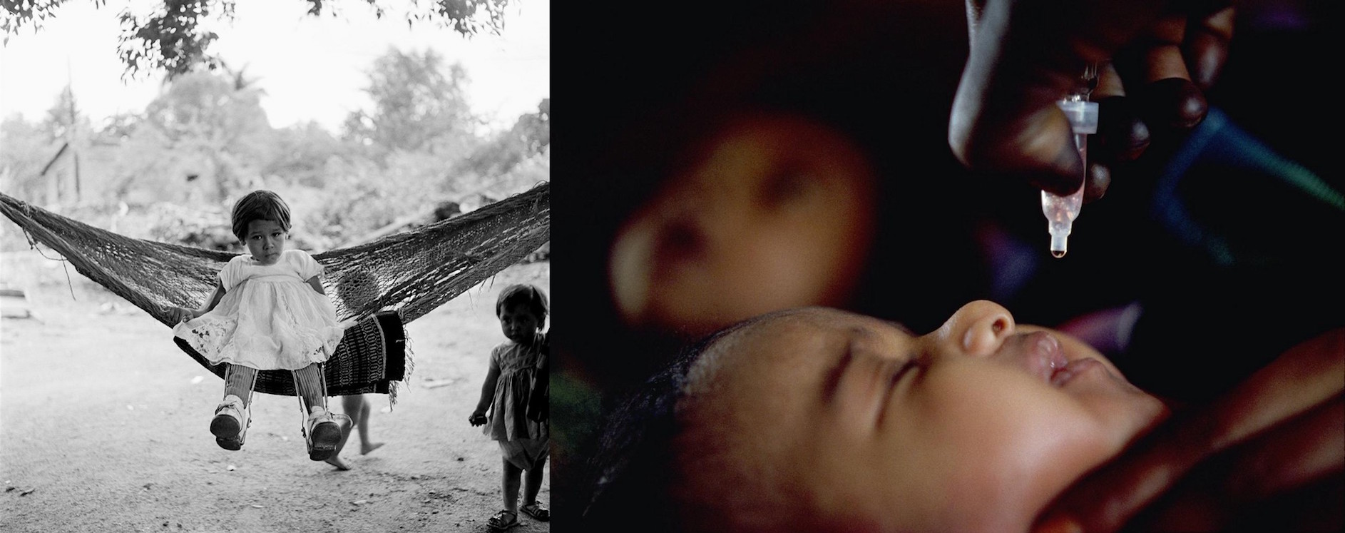 (Left) In 1960 in Mexico, three-year-old Concepcion Uribe wears leg braces to support her polio-weakened limbs outside a rural health centre. (Right) In 1991 in Sudan, a baby receives a dose of oral polio vaccine in a children’s clinic in Khartoum.