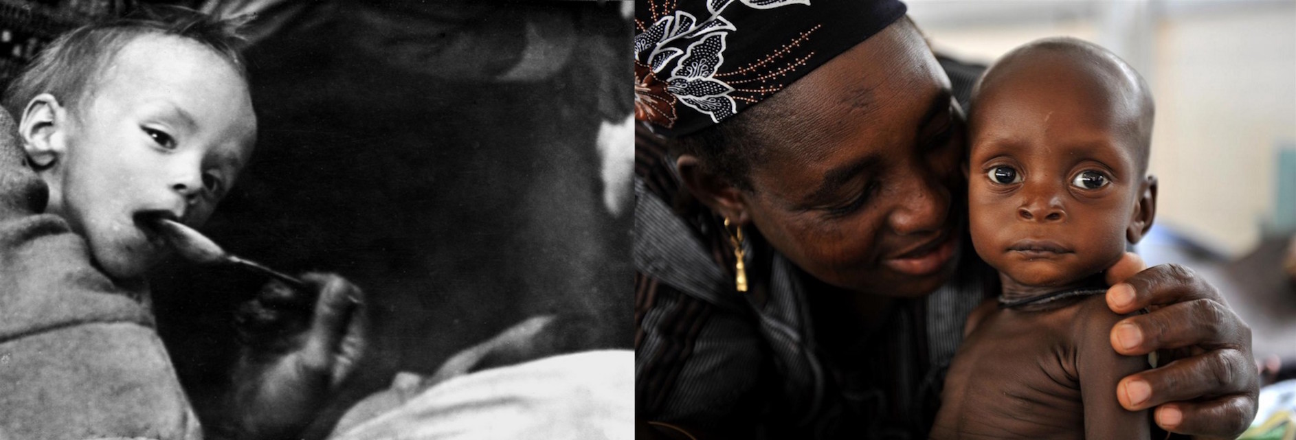 (Left) Circa 1946 in Greece, a severely malnourished boy is fed with a spoon. (Right) In 2009, a woman embraces her severely malnourished child at a nutritional rehabilitation centre in Niger.