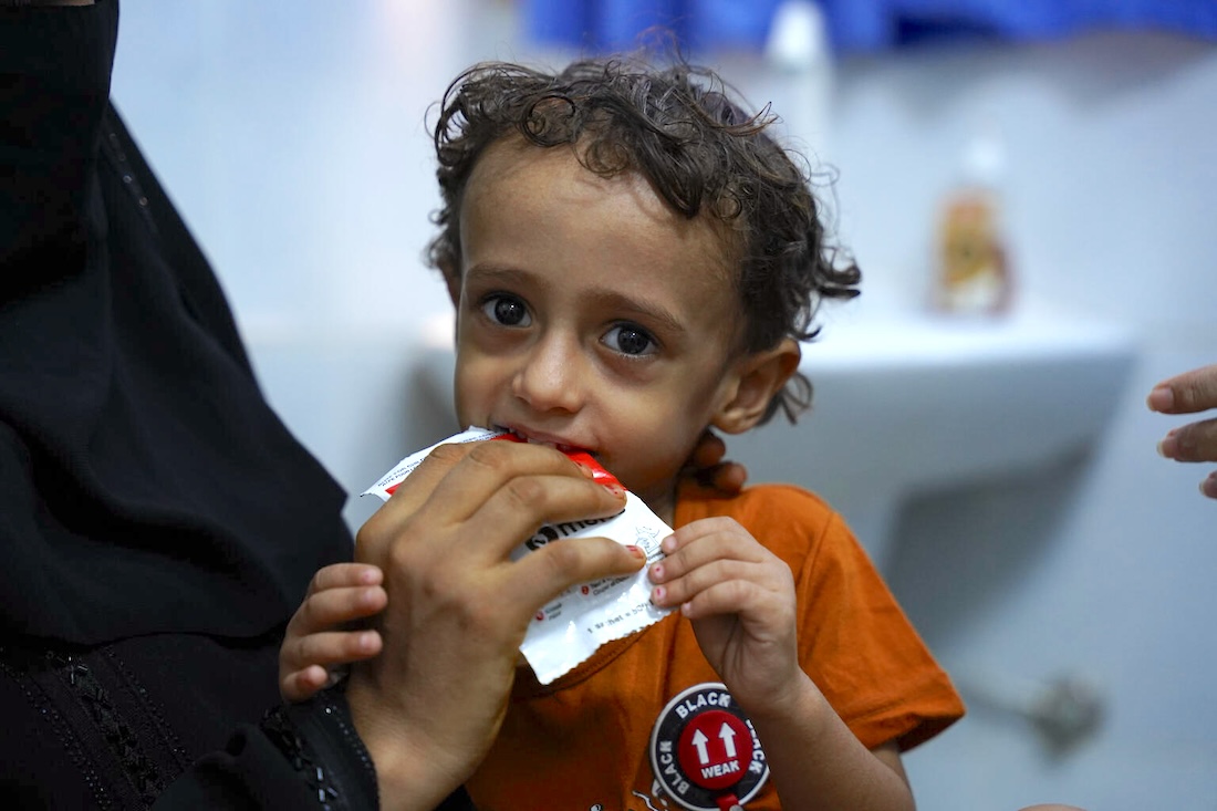 Acute Malnutrition Surges in Yemen | UNICEF USA