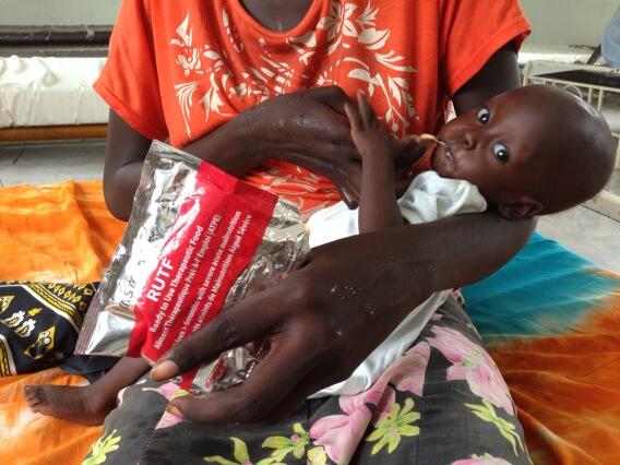 A South Sudanese mother feeds her malnourished child ready-to-use therapeutic food.