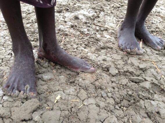 Many of the 1.3 million South Sudanese who have fled the conflict do not even have shoes.