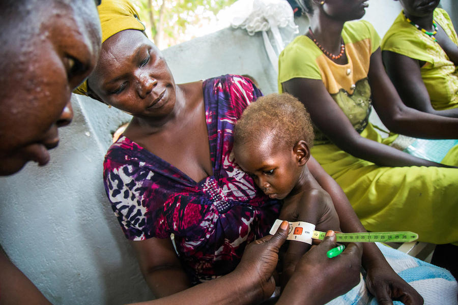 A nutritionist measures 2-year-old Maria's mid-upper arm circumference. Maria is being treated for severe acute malnutrition at a UNICEF-sponsored hospital in Juba, South Sudan, October 2017.