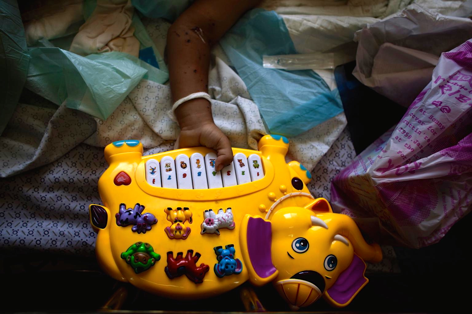 A wounded girl plays with a toy while recovering at Al-Shifa Hospital in Gaza. © UNICEF/NYHQ2014-1038/d’Aki