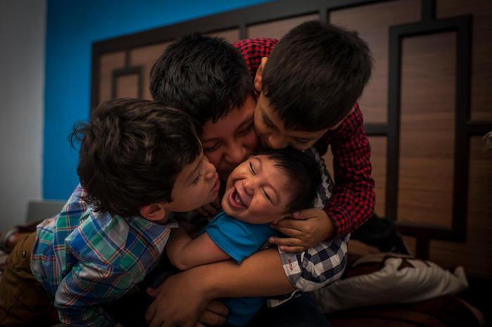 Danilo of Guatemala, center, surrounded by his siblings, suffers from Congenital Zika Syndrome and microcephaly.