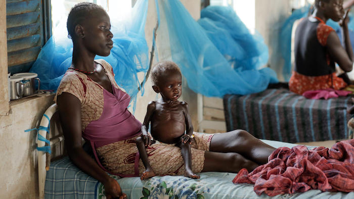 A mother and child rest at a UNICEF-supported nutrition stabilization center in Pibor, Jonglei state, South Sudan.