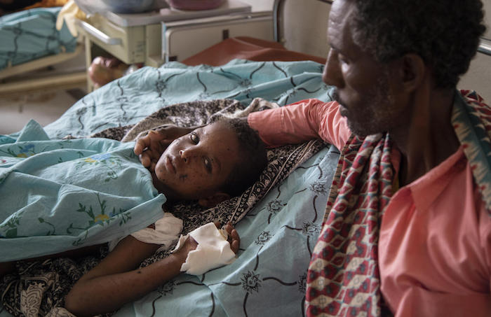 At a hospital in Tigray, Ethiopia, a 10-year-old boy recovers from injuries from a grenade explosion.