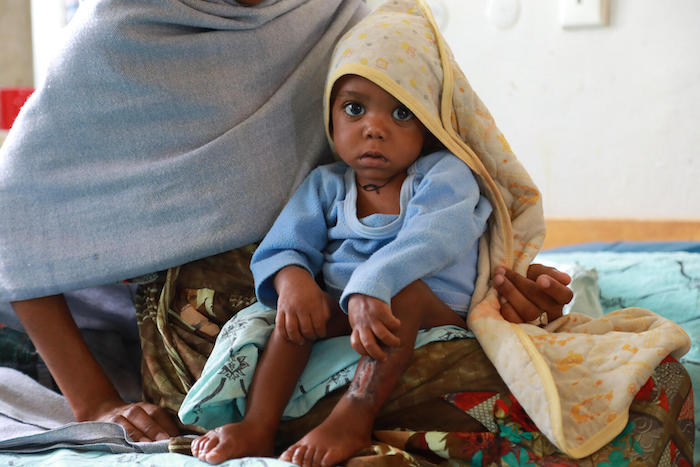 A mother sits with her child who is being treated for severe acute malnutrition at a UNICEF-supported facility in Mekelle, Tigray, Ethiopia.
