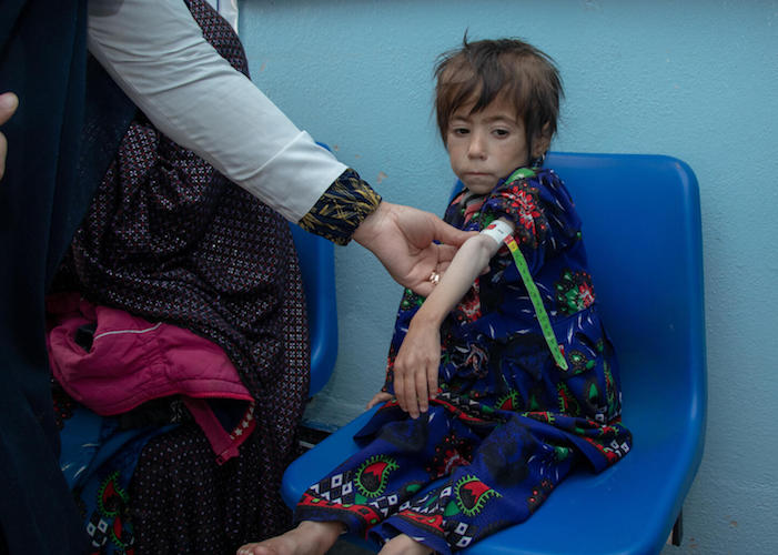 In Herat, Afghanistan, a UNICEF-supported health worker uses a MUAC tape to measure a child's mid-upper arm circumference, a quick way to diagnose severe acute malnutrition.