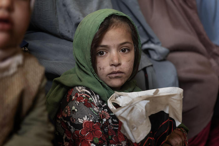 A girl in the waiting room of the UNICEF-supported Mirza Mohammad Khan clinic in Kandahar, Afghanistan.