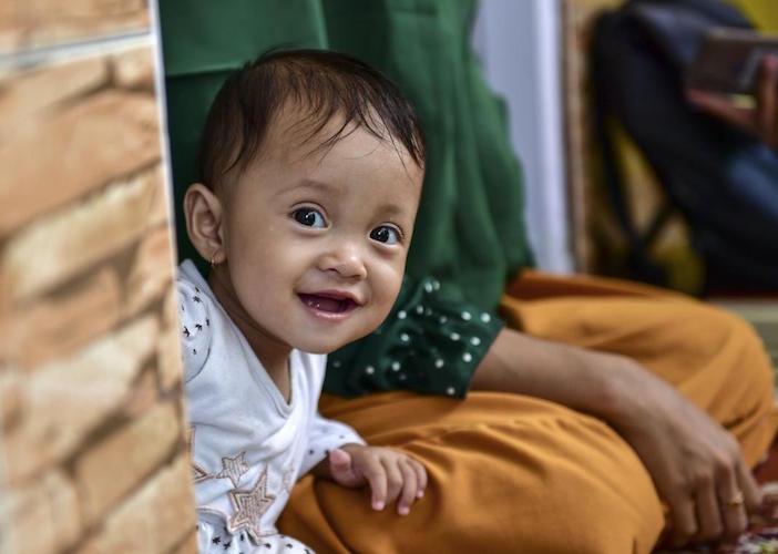Just eight weeks of treatment with locally produced RUTF helped little Adifa recover severe wasting and regain her health. 