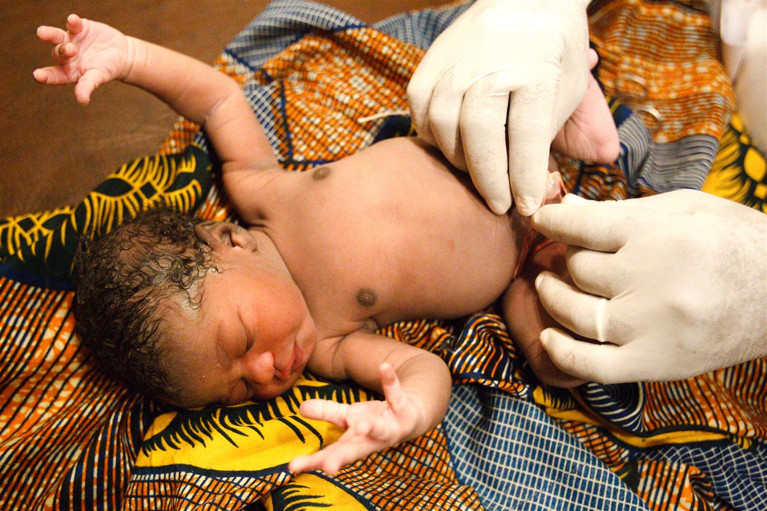 A health worker ties the umbilical cord of a newborn child who lies on a warming UNICEF-sponsored, locally-crafted warming table at the Kita reference health center in the town of Kita, Mali on Friday August 27, 2010.