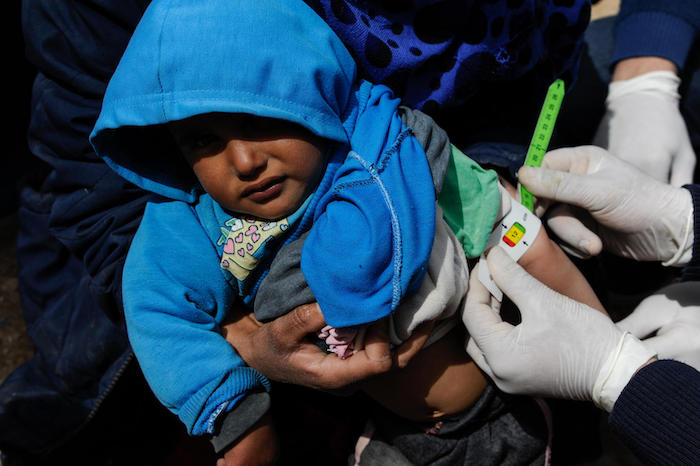 A child is screened for malnutrition at a camp for internally displaced persons in rural Ar-Raqqa, Syria.