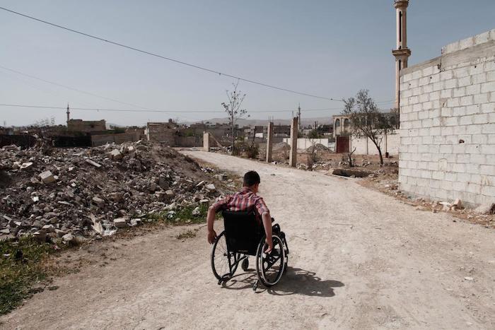 Moaz, 14, of Douma, east Ghouta, Syria, lost his right leg four years ago in a blast that hit the market where he was buying food for his family.