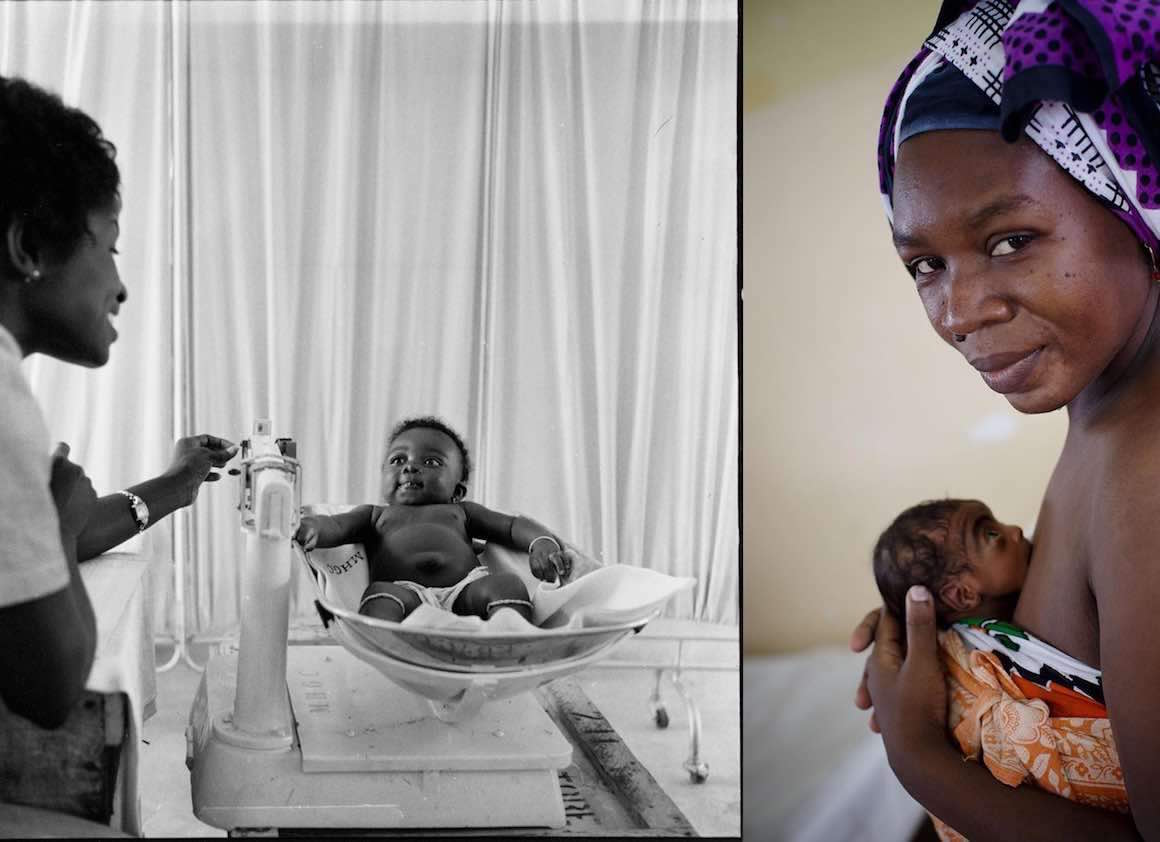(Left) In 1960 in Ghana, a midwife weighs a child on a scale in a comprehensive long term rural health plan emphasising training of medical personnel in Tuma. (Right) In 2014, a woman cradles her preterm baby using ‘kangaroo care’ against her skin to keep