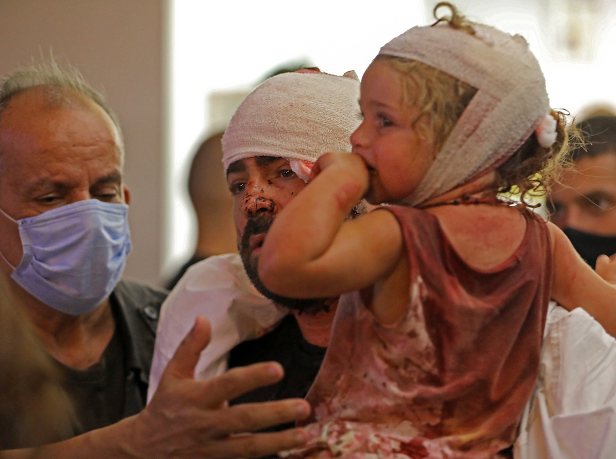 Wounded people are treated at a hospital following an explosion near the port in the Lebanese capital Beirut on August 4, 2020.