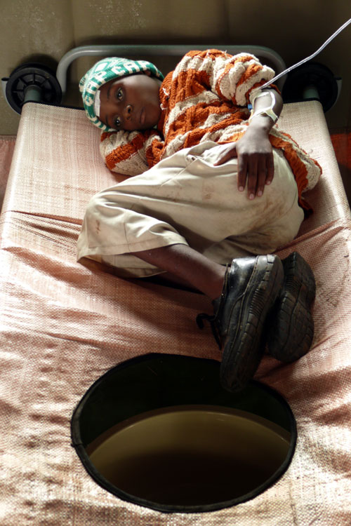 At a cholera treatment centre in the town in Zimbabwe, a girl receives intravenous fluids through a drip into her arm. Intravenous administration of rehydration solution is needed in severe cholera cases to replace fluids.