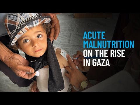 Thumbnail for video Acute Malnutrition on the Rise in Gaza