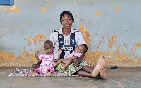 A young mother sits with her 2-month-old son and 22-month-old daughter Marie, who is being treated for severe acute malnutrition, outside their room at the UNICEF-supported nutrition center at Saint Jean de Dieu Hospital, Tanguiéta, northern Benin.