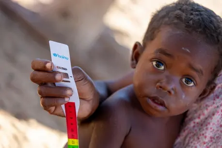Fenosoa is being taught how to do malnutrition screening on her 9-month-old son in the village of Matangy, South Western Madagascar. Food and nutritional insecurity continues to be fuelled by the devastating effects of cyclones, recurring droughts and poor harvests, among other factors.