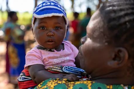 On Jan. 30, 2024, a child is held by her parent at a UNICEF-supported immunization session in Chinkuyu village, Malawi.