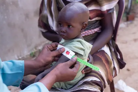 On Sept. 17, 2024, 14-month-old Ismail is screened for malnutrition at UNICEF-supported Elhmedia health center in Rokoro, Central Darfur, Sudan.