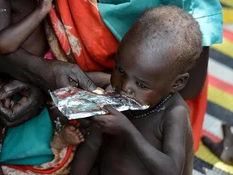 Child Eating Therapeutic Food