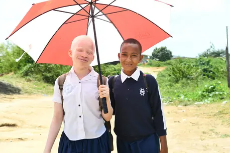 12-year-old girl from Côte d'Ivoire with albinism, with her friend. 12-year-old girl from Côte d'Ivoire with albinism, with her friend.