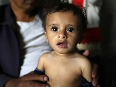 In the midst of the world's worst humanitarian crisis, UNICEF and partners are working to save and protect the children of Yemen. Yemen, Unicef, humanitarian aid, malnourished children