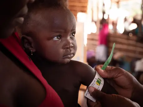 On September 27, 2019, a boy has his mid-upper arm circumference measured by a health worker at a UNICEF-supported community outreach medical center near the village of Mecufi in northern Mozambique. On September 27, 2019, a boy has his mid-upper arm circumference measured by a health worker at a UNICEF-supported community outreach medical center near the village of Mecufi in northern Mozambique.