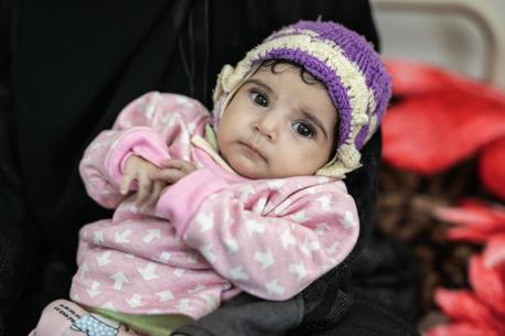Ethar, 4 months old, is recovering from malnutrition at a UNICEF-supported hospital in Sana'a, Yemen. 