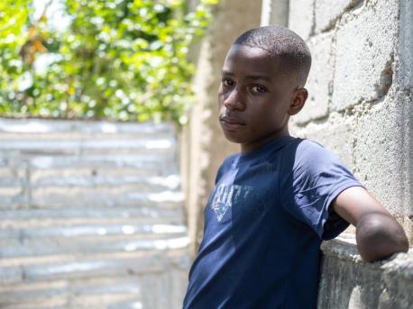 Peterson, 14, lost his arm in Haiti's 2010 earthquake. 