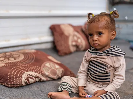 One-year-old Ghosson was treated for severe acute malnutrition at UNICEF-supported Al Sadaqa Hospital in Aden, Yemen in 2021. One-year-old Ghosson was treated for severe acute malnutrition at UNICEF-supported Al Sadaqa Hospital in Aden, Yemen in 2021.