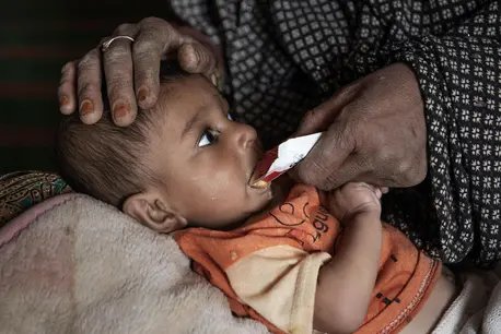 In Maywand, Afghanistan, a 9-month-old boy suffering from severe acute malnutrition is given a packet of Ready-to-Use Therapeutic Food (RUTF) provided by a UNICEF-supported mobile health and nutrition team. In Maywand, Afghanistan, a 9-month-old boy suffering from severe acute malnutrition is given a packet of Ready-to-Use Therapeutic Food (RUTF) provided by a UNICEF-supported mobile health and nutrition team.