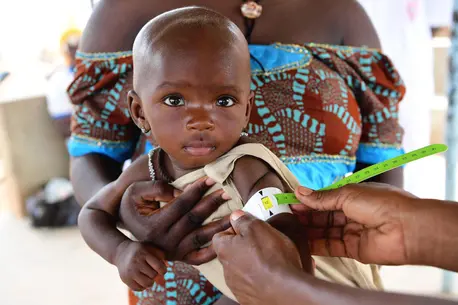 A mother with her baby at a UNICEF-supported health center in Fada, in eastern Burkina Faso where children are screened for malnutrition and vaccinated. A mother with her baby at a UNICEF-supported health center in Fada, in eastern Burkina Faso where children are screened for malnutrition and vaccinated.