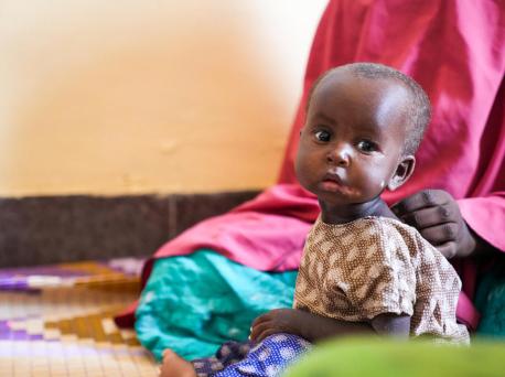 On 25 May 2022, 10-month-old Marwo, who is malnourished, sits with her mother at UNICEF-supported Banadir Hospital in Mogadishu, Somalia.