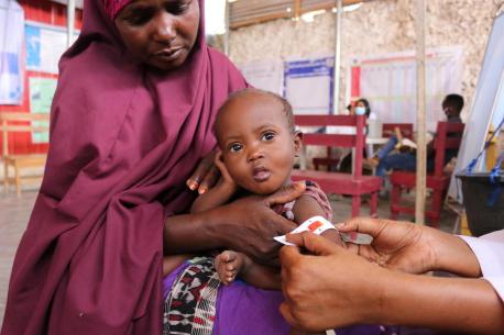 A health worker screens 2-year-old Sabirin for malnutrition at a UNICEF-supported health center outside Mogadishu, Somalia.