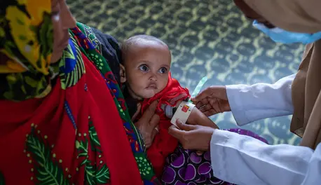 A health care worker screens 8-month-old Latu to measure the progress of her treatment for severe acute malnutrition at the UNICEF-supported Dubuluk Health Center in Ethiopia. A health care worker screens 8-month-old Latu to measure the progress of her treatment for severe acute malnutrition at the UNICEF-supported Dubuluk Health Center in Ethiopia.