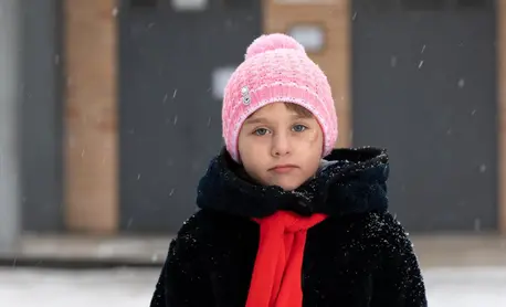 Polina, 7, of Eastern Ukraine bears the scars of injuries she suffered when a shell exploded outside the family home. Polina, 7, of Eastern Ukraine bears the scars of injuries she suffered when a shell exploded outside the family home.
