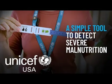 Thumbnail for video An Innovative Tool to Detect Malnutrition in Infants and Their Moms