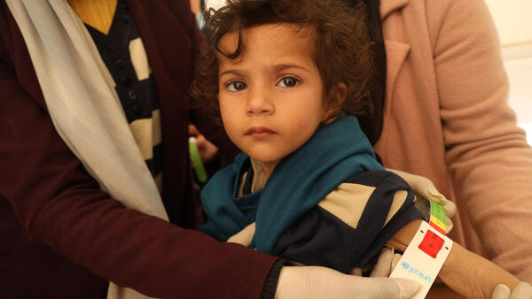 In the Gaza Strip on Feb. 15, 2024, a UNICEF-trained screener measures 2-year-old Leen's mid-upper arm circumference; the reading in red indicates she is suffering from severe acute malnutrition, the most visible and life-threatening form of malnutrition.