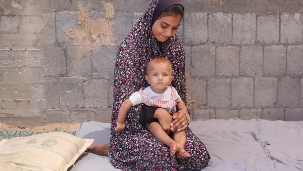 Sahaed Kashko, a mother from Gaza, holds her young daughter, who suffers from malnutrition.